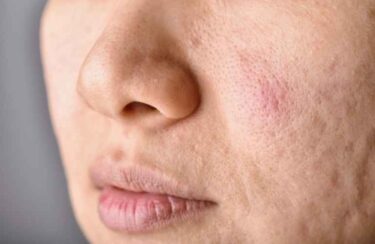 顔を見れば病気がわかる！健康のヒントは顔に隠されている